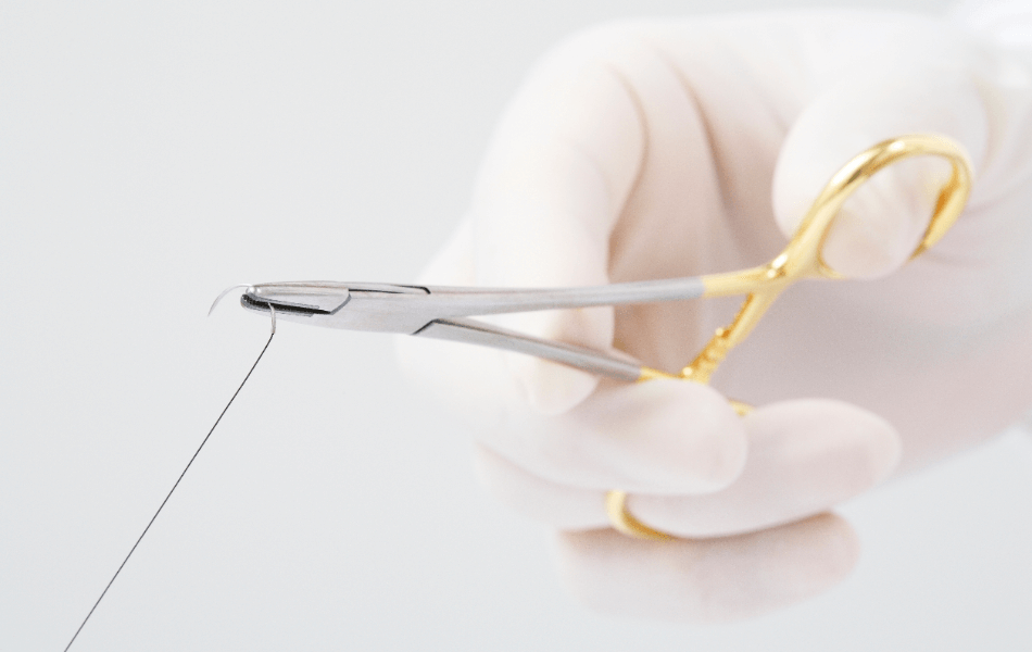 【徹底解説】粉瘤手術の流れや術後の経過・術後の注意点