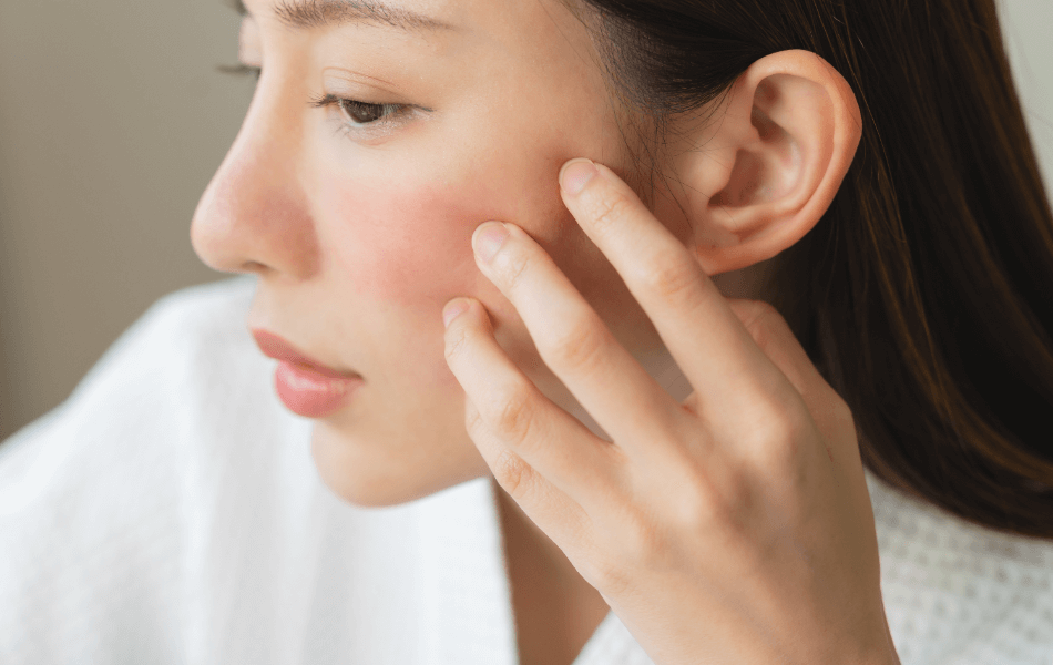 顔にできたできものはニキビじゃない？ニキビ以外のできものについて徹底解説