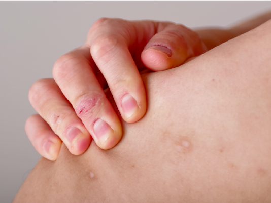 湿疹からできものまで対応