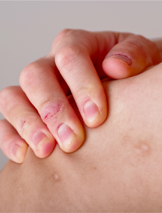 湿疹からできものまで対応