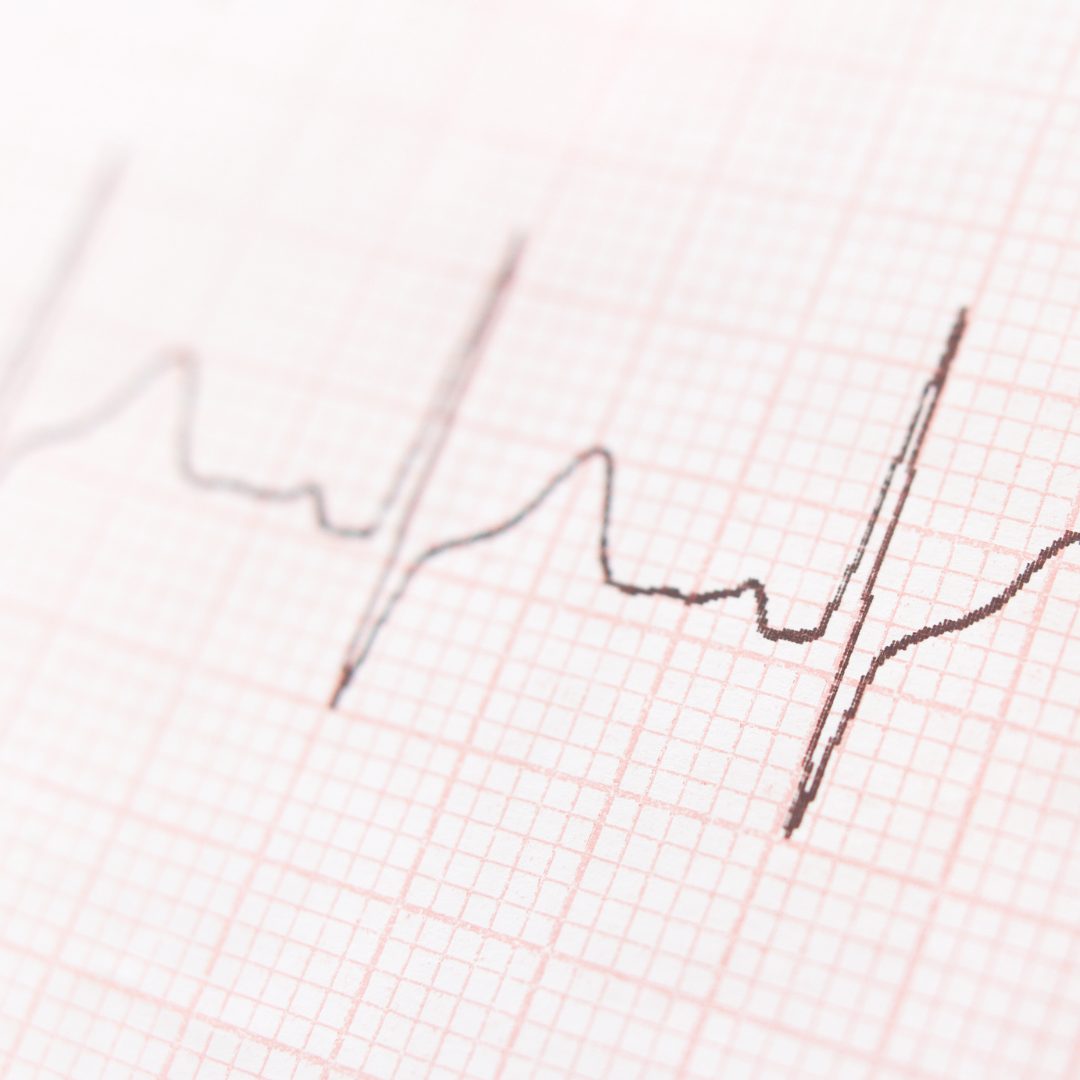動悸とは?身近な原因と対策について【浅草橋西口クリニックMo】