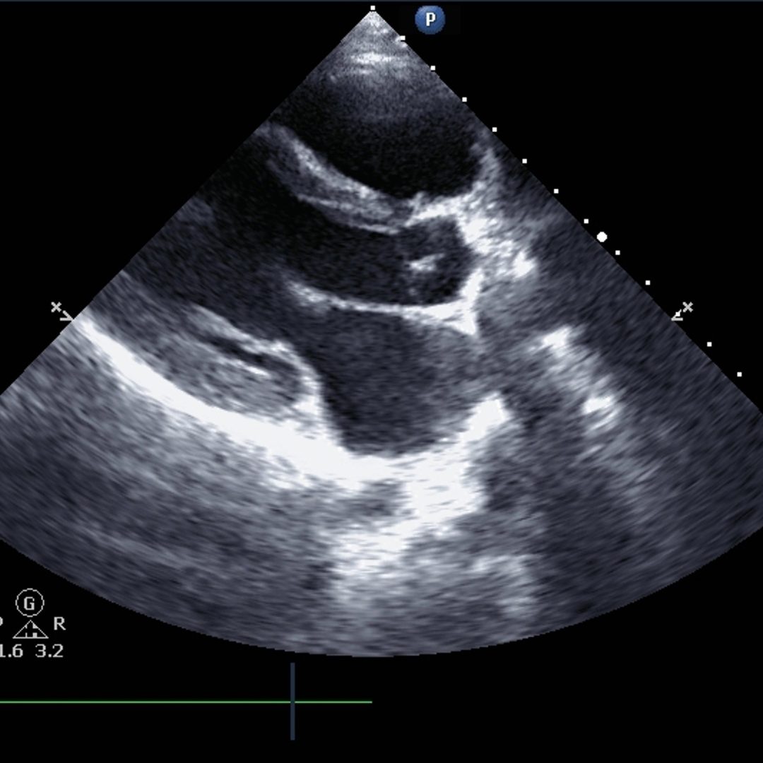動悸とは?身近な原因と対策について【浅草橋西口クリニックMo】