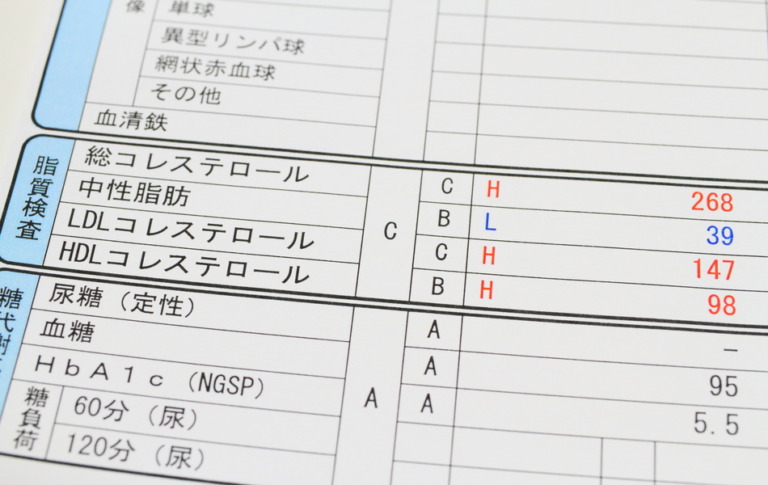 脂質異常症を改善する方法とは？原因や放置するリスクも紹介